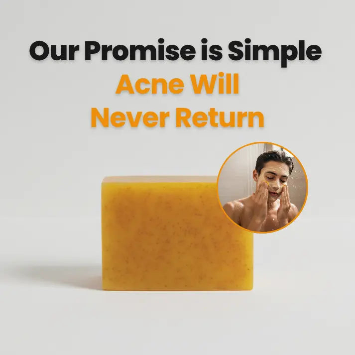 Clear Teen Acne & Redness Bar