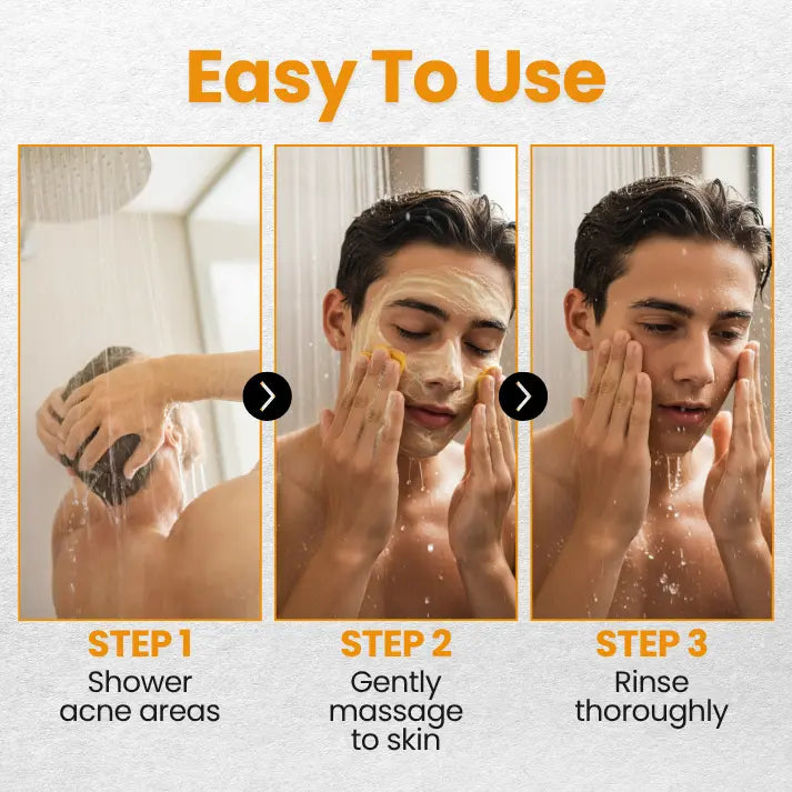 Clear Teen Acne & Redness Bar