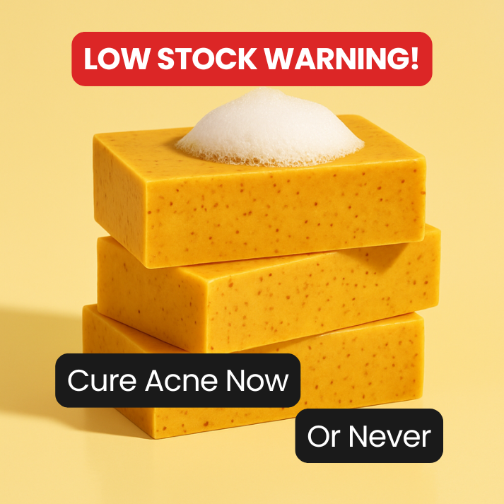 Clear Teen Acne & Redness Bar