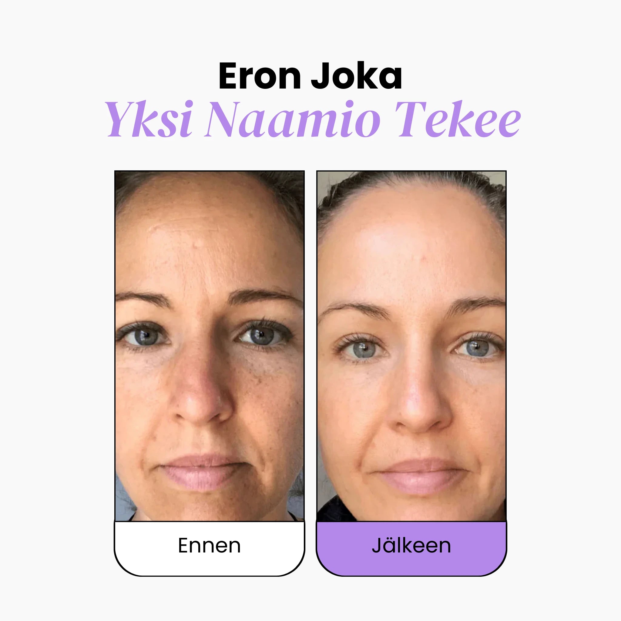 Bio-Kollageeninaamio Juonteille